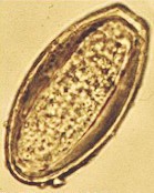 Egg of Oxyuris equi. Image taken from www3.vetagro-sup.fr