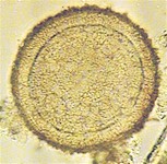 Egg of Parascaris equorum. Image from www.proprofs.com