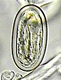 Egg of Physaloptera spp. Picture from www.vetbook.org