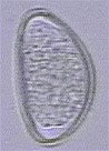 Egg of Skrjabinema spp. Picture from www2.vetagro-sup.fr