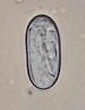 Huevo de Spirocerca lupi. Imagen tomada de yourownvet.com