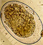 Egg of Hyostrongylus rubidus. Picture from www.fiatlux.egloos.com