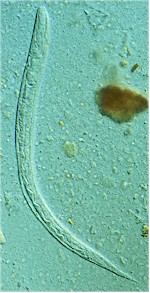 Larva of Strongyloides stercoralis. Picture from Wikipedia Commons.