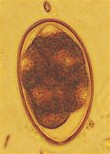 Syngamus trachea egg. Picture taken from www.tierarzt-sudhoff.de