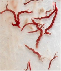 Syngamus trachea adult worms. Picture from https://datashare.is.ed.ac.uk/handle/10283/2201.