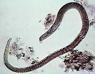 Ejemplar adulto de T. spiralis. Imagen tomada de www.pasozyty.com.pl