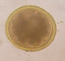 Egg of Toxocara canis. Picture from Wikipedia Commons