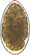 Egg of Trichostrongylus spp. Picture from Wikipedia Commons.