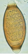 Típico huevo de Trichuris spp. © J. Kaufmann / Birkhäuser Verlag.