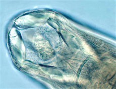 Cabeza de Uncinaria stenocephala con cápsula bucal. Imagen tomada de www.capcvet.org