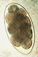 Huevo de Uncinaria stenocephala. Imagen tomada de www.vetbook.org