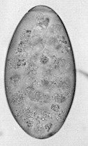 Huevo de Alaria spp. Se percibe el opérculoen la parte superior. Imagen tomada de www.apacapacas.com