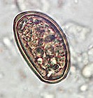 Dicrocoelium eggs. Picture from Wikipedia Commons