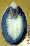 Ejemplar adulto (conservado) de Fasciola hepatica (vista dorsal)