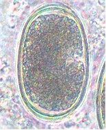 Egg of Heterakis spp. Picture from www.wageningenur.nl