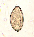 Egg from Opistorchis viverrini. Picture from www.dpd.cdc.gov