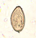 Huevo de Opistorchis viverrini. Imagen tomada de www.dpd.cdc.gov