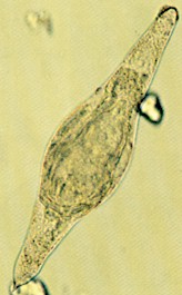 Huevo de Schistosoma. © J. Kaufmann / Birkhäuser Verlag