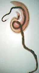 Adult blood flukes: male (thick and short) and female (thin and long). Imagen from www.pathguy.com